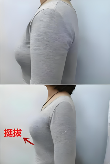 什么是乳房悬吊(乳房悬吊原理详解)