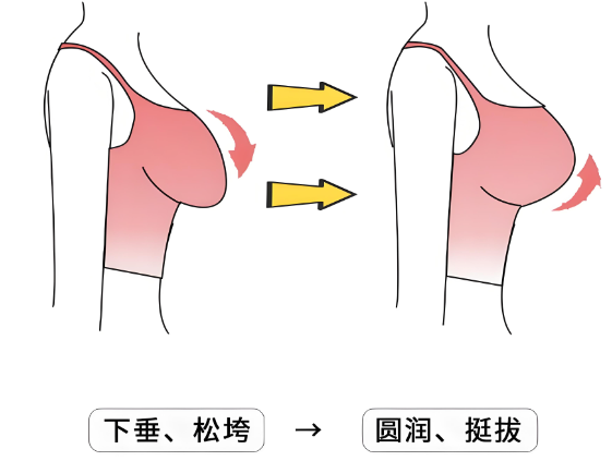 治疗乳房下垂禁忌人群? 