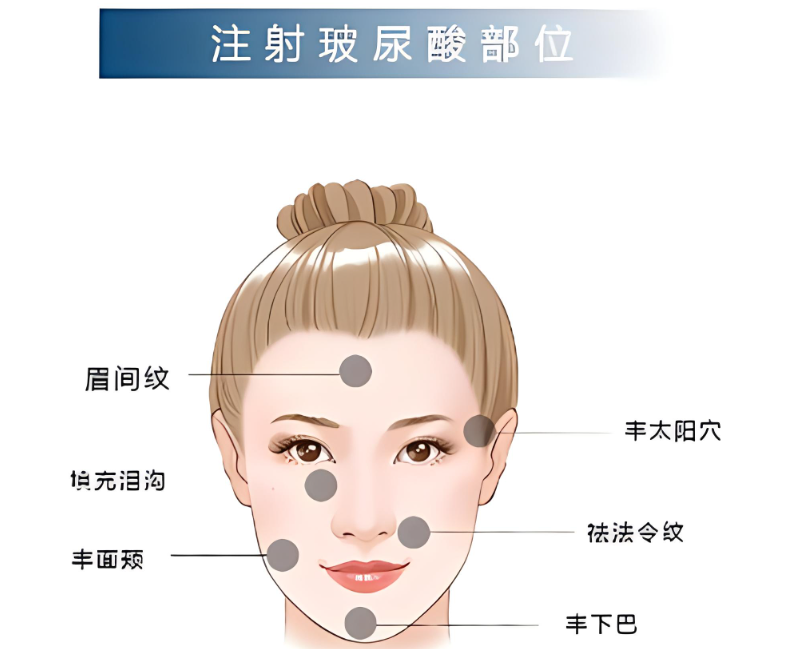 玻尿酸的作用与功效?玻尿酸是什么