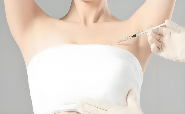 注射丰胸后乳房会有填充物影响乳房血液循环问题吗？
