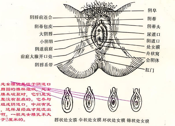 Hymen reconstruction