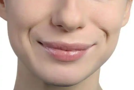 Mouth lines
