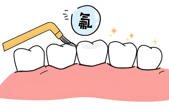全口氟保护漆对牙齿有何作用？