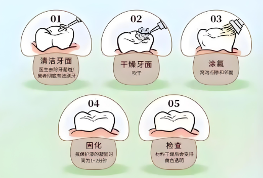 全口氟保护漆的安全性如何？