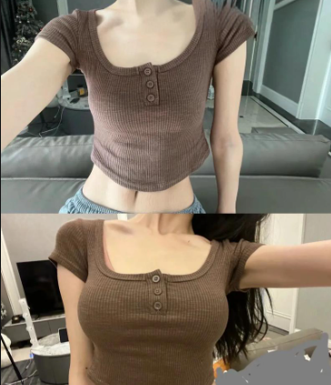 假体丰胸手术有哪些优势？